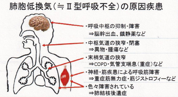 その他の治療法